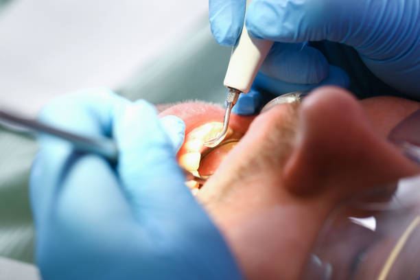 Best Emergency Care for Gum Disease in Williamstown, KY