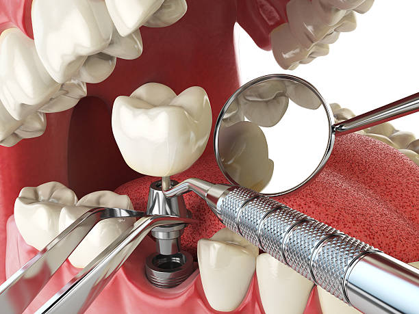 Best Emergency Orthodontic Repairs in Williamstown, KY