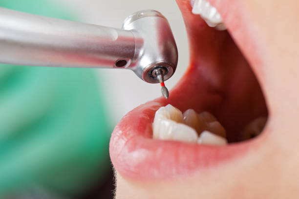 Best Emergency Root Canal Therapy in Williamstown, KY
